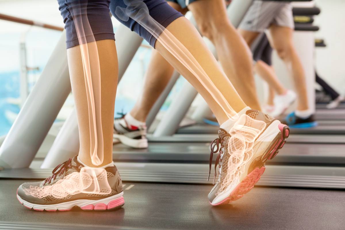 People on a treadmill that have good health from eating the best diet for foot bone health.